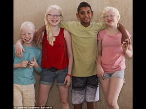 Brazilian mother gives birth to three albino children - while their three siblings are black