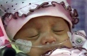World's third smallest baby leaves US hospital