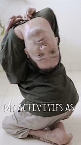 116K views · 665 reactions | I was born with an upside down head #reels #viral #borndifferent #motivationalspeaker #inspiring | Born Different | Facebook