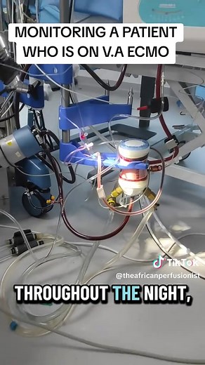 Monitoring a Patient on VA ECMO: Key Insights