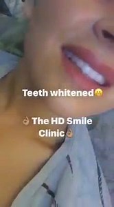 16K views · 3 comments | The HD Smile Clinic on Reels | Facebook