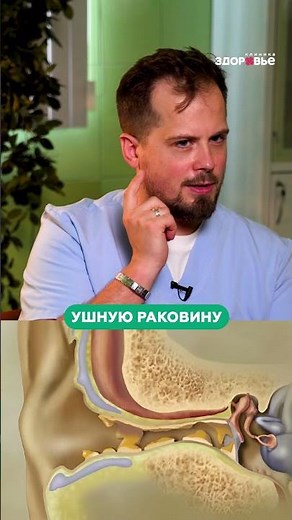 КАК ПРАВИЛЬНО чистить уши? #уши #ватныепалочки #слух