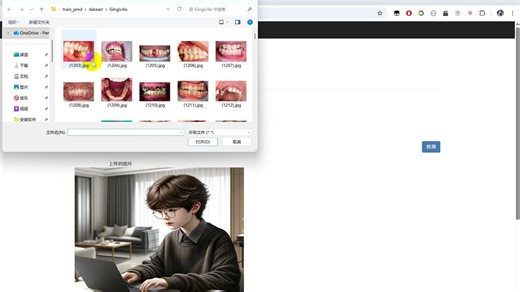 【牙齿牙疾系统】Python TensorFlow Django 人工智能 深度学习 卷积神经网络算法