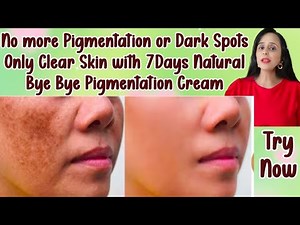 Solution of Pigmented Skin Issues with 7 Days Natural Bye Bye Pigmentation Cream |#hyperpigmentation