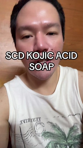 SCD Kojic Acid Soap honest review after 1 week