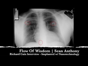 Richard Cain: Implanted with Nanotechnology, Docs, Images & proof of being a Targeted Individual