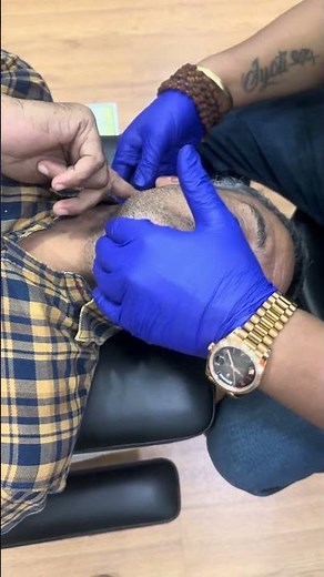 Spine Alignment for Neck Pain | Real Chiropractic Session | Dr. Rajneesh Kant #viral