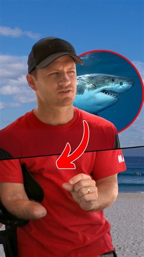 210K views · 3.1K reactions | The worst attack in decades! Surfer gets brutally attacked by shark at Bondi | Bondi Rescue | Facebook