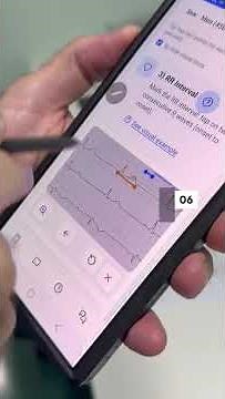 Learn how to measure the corrected QT interval (QTc) using Kraemer Academy’s qtc.mocha.app app.