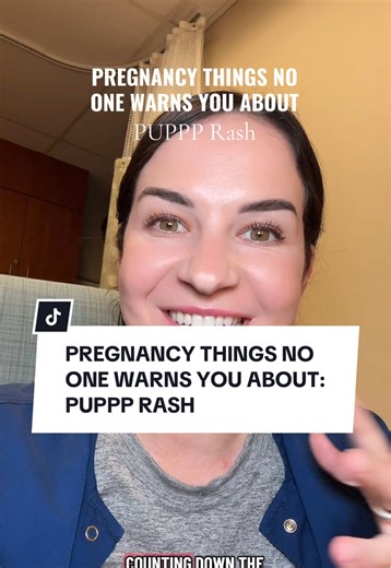 Understanding PUPPP Rash During Pregnancy