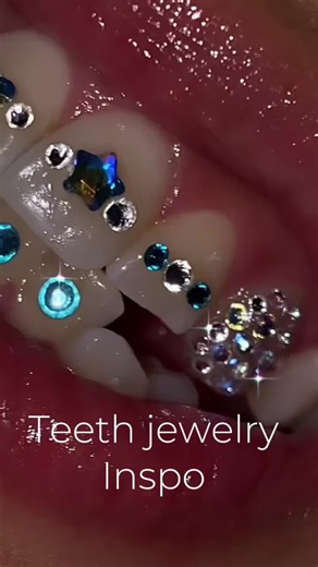 Tooth Gems: Enhance Your Smile with Luxury