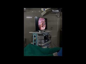 4k Endoscopy Laparoscopic camera UHD-LP-6000 by ESC Medicams