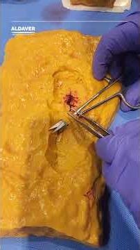 Experience the Realistic Tissue Dissection Model | ALDAVER Surgical Simulator