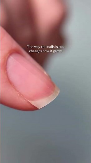 Why Your Nails Are Peeling & Splitting (And How to Fix It) | Better Nail Clipper Routine