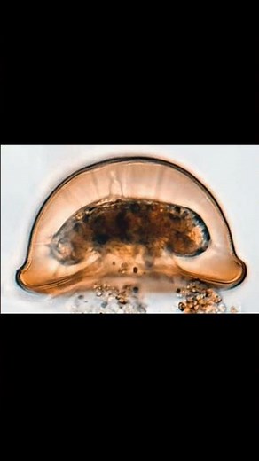 Arcella ( superclass Rhizopoda)