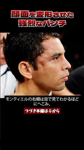#Boxing The legendary left hook that caused a facial fracture - Donaire vs Montiel