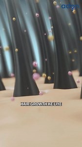 1.1K views · 16 reactions | Minoxidil Ka Naya Side Effects | Hair Loss | Hair Regrowth | Hair Tips | Hair Expert #viralshort | Waidon | Facebook