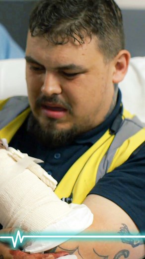 The Emergency Room on Instagram: "He almost cut his arm off  #reels #accident #medicalemergency #doctor #surgery"