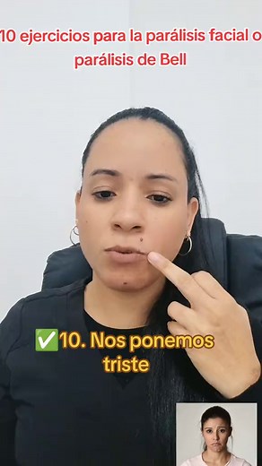10 Ejercicios Efectivos para la Parálisis Facial: Terapia y Rehabilitación en Casa