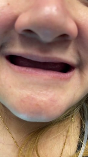 One smile at the time 😬🦷🥰 #fyp #dentures #dentalimplants #satisfying #foryou