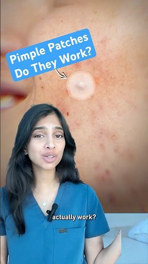 Do pimple patches work?