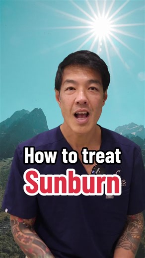 How to Treat Sunburn: Effective Relief and Remedies