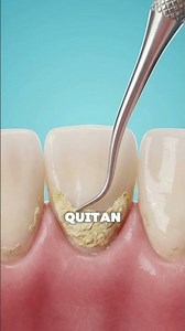 What happens when you get your tartar removed? 🦷 #3d #didyouknow #curiosities #science