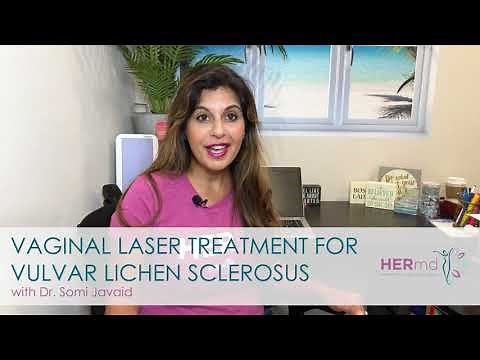 Vaginal Laser Treatment for Vulvar Lichen Sclerosus