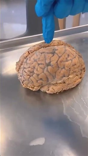 CÉREBRO HUMANO REAL! 🤯 O Segredo para Ter um Cérebro Mais Inteligente