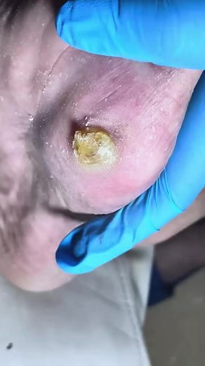 9.8K views · 82 reactions | What’s hiding under this toenail will shock you 7X6U Beautiful moments of care and relaxation through a gentle pedicure experience. Simple, clean, and satisfying. ✨ Disclaimer: This video is for educational and relaxation purposes only. All content belongs to the respective owners, no copyright infringement is intended. | Sharlene Rodriguez | Facebook