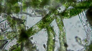 clip-4946054-seaweed-algae-under-microscope-magnification-100x
