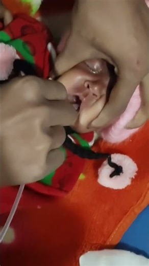 baby's throat nali process #nicuwarrior #trendingshorts #niculife #childhealth #love #medicalstudent