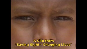 Saving Sight - Changing Lives