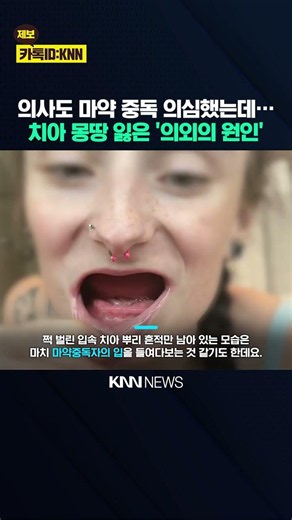 Her Teeth Were 'Gone' When She Opened Her Mouth—What Happened? Even Doctors Suspected Drugs, But ...