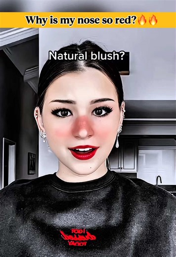 🔥How to make a red nose filter🔥 How to create a sensitive-skin filter effect🔥 How to make a natural blush glow🔥 How to create a natural cheek-blush look Why is my nose so red?🍓 Want to create this red-nose sensitive-skin natural blush effect?🔥 How to make a red nose filter🔥 How to create a sensitive-skin filter effect🔥 How to make a natural blush glow🔥 How to create a natural cheek-blush look #capcut #capcutpioneer#capcutforus#fyp