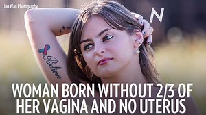 Woman born without 2/3 of her vagina and no uterus speaks out on infertility: 'I felt alone' http://peoplem.ag/HyL0L3q | People