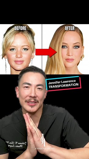 Jennifer Lawrence's Transformation at the 2024 Oscars