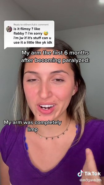 Left Hemiplegia: My Arm's Journey After Stroke