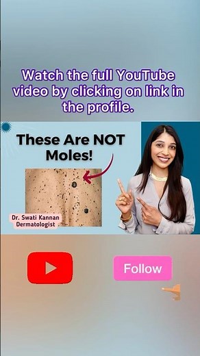 Are These Skin Barnacles Cancerous? Seborrheic Keratosis | Dr. Swati Kannan #shorts