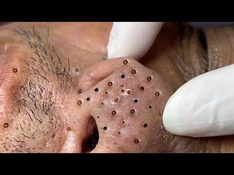 𝑺𝒐𝒐𝒕𝒉𝒊𝒏𝒈 𝑭𝒂𝒄𝒊𝒂𝒍 𝑻𝒓𝒆𝒂𝒕𝒎𝒆𝒏𝒕 𝑭𝒐𝒓 𝑺𝒕𝒓𝒆𝒔𝒔 𝑹𝒆𝒍𝒊𝒆𝒇 𝒂𝒕 𝑳𝒖𝒙𝒖𝒓𝒚 𝑺𝒑𝒂 𝑨𝒄𝒉𝒊𝒆𝒗𝒆 𝑰𝒏𝒏𝒆𝒓 𝑷𝒆𝒂𝒄𝒆 #500392"