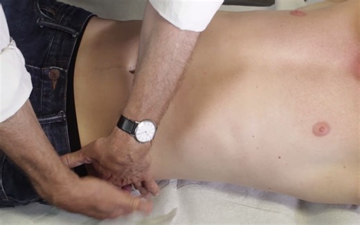 【腹部检查】Examination of the Abdomen - Clinical Examination