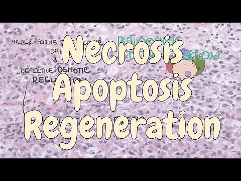 Necrosis, apoptosis and regeneration - liver pathology