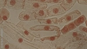 Mitosis cell in the Root tip of Onion under a microscope.