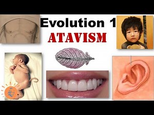 Atavism | Reversion | Evidences of Evolution | Tail in Human Baby | Dr Ghanshyam Jangid
