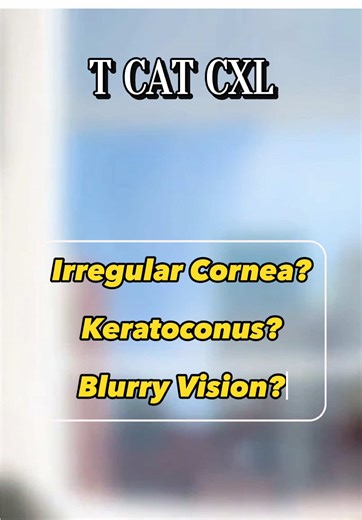 Keratoconus Treatment at Amanat Eye Hospital