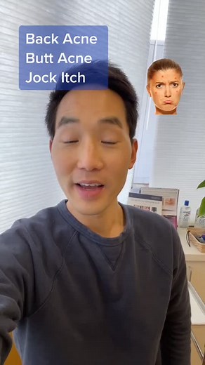 Effective Tips to Treat Back and Butt Acne, Including Jock Itch