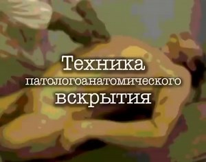 Technique Of Pathological Anatomical Dissection