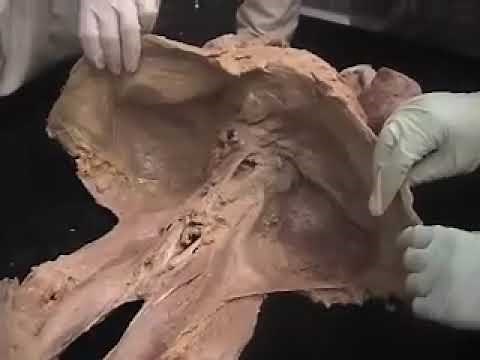 Deep Front Line of Fascia - Cadaver Dissection by Tom Myers