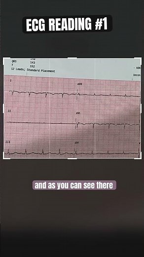 READ YOUR HEART 💗 #viral #youtubeshorts #hospital #funny #doctor #youtube #science