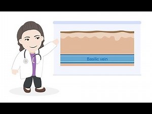 Optimizing dialysis access using ultrasound